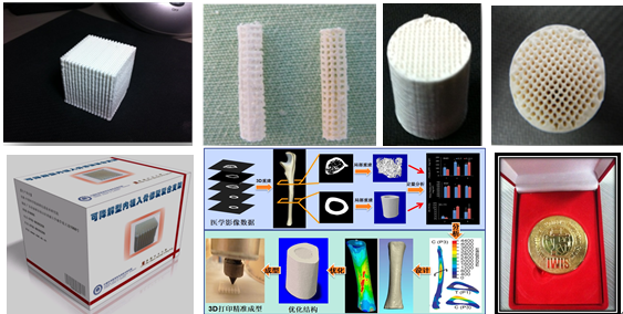 新型3D打印骨修复多孔支架材料
