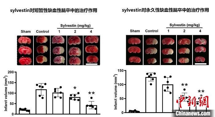 科研人员从山蛭中发现可显著治疗缺血性脑卒中的活性多肽