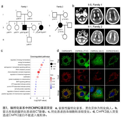 研究揭示CMPK2基因缺陷导致线粒体障碍和家族性脑钙化症