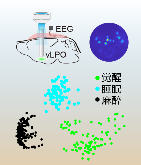 科学家发现全身麻醉对睡眠核心网络的调控规律